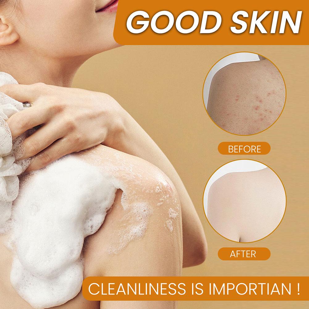 100g Turmeric & Kojic Acid Handmade Soap