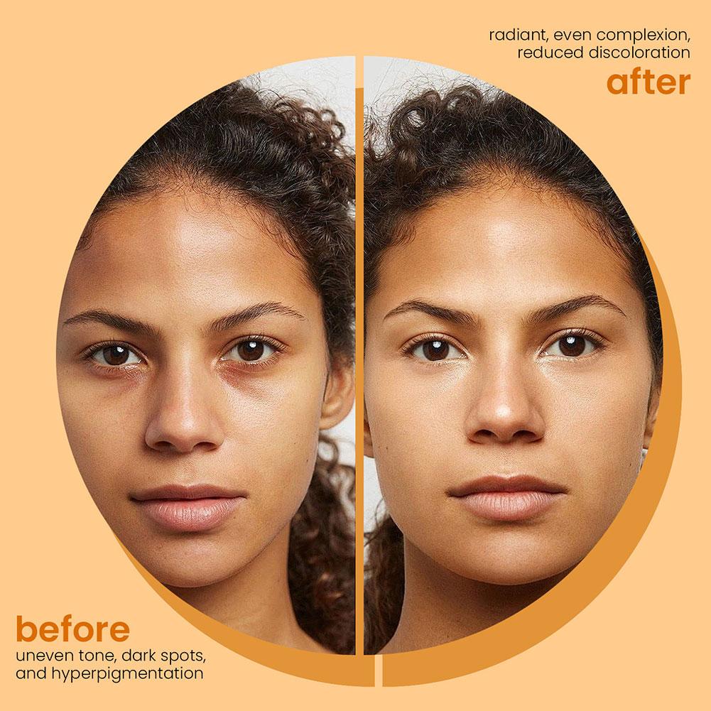 100g Turmeric & Kojic Acid Handmade Soap