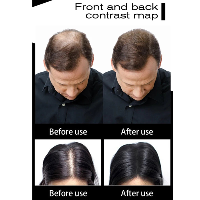 Sevich Hair Fibers Refill Bag 100g