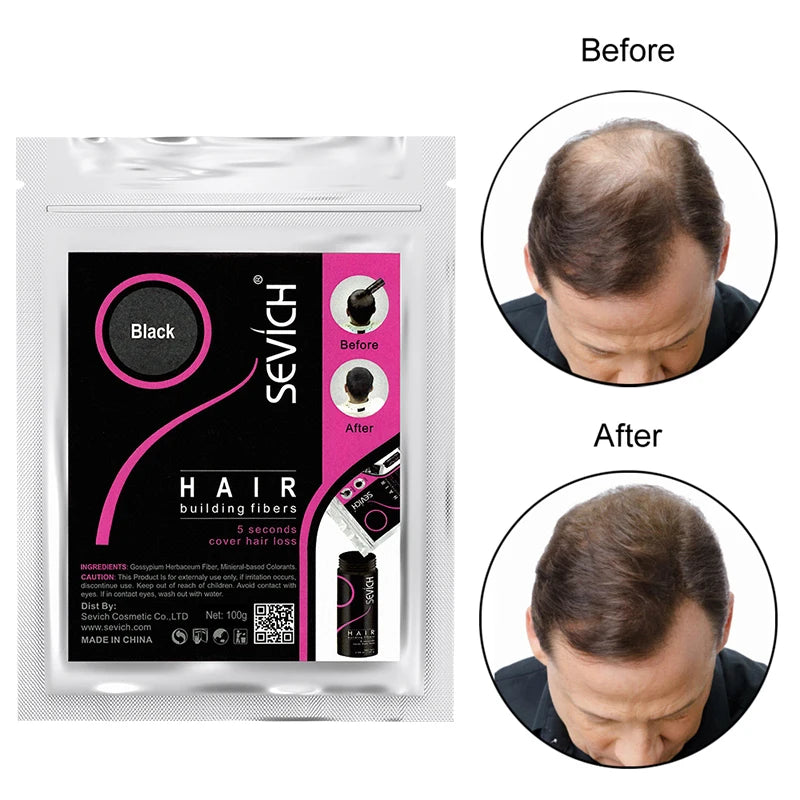 Sevich Hair Fibers Refill Bag 100g
