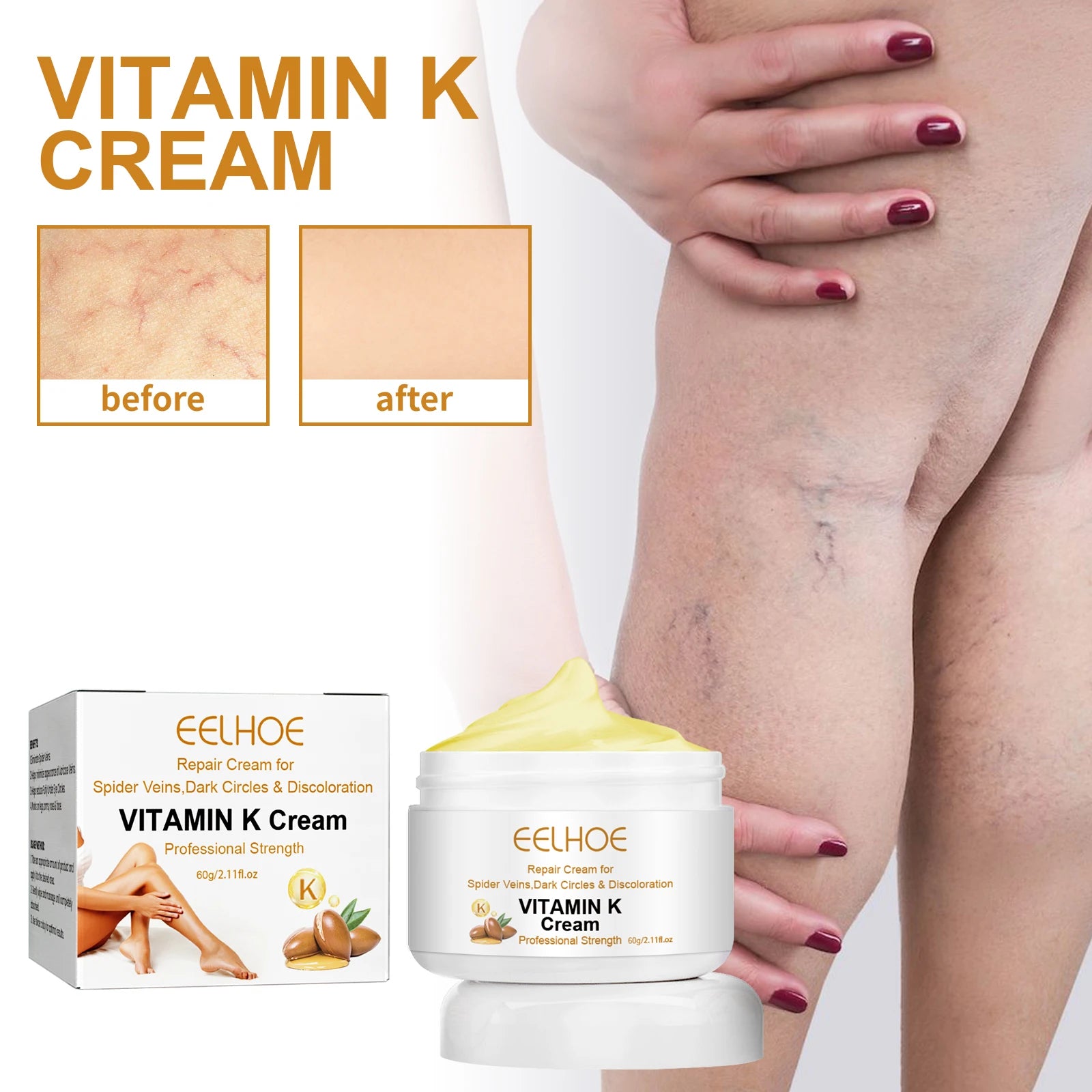 EELHOE Vitamin K Herbal Vein Care Cream