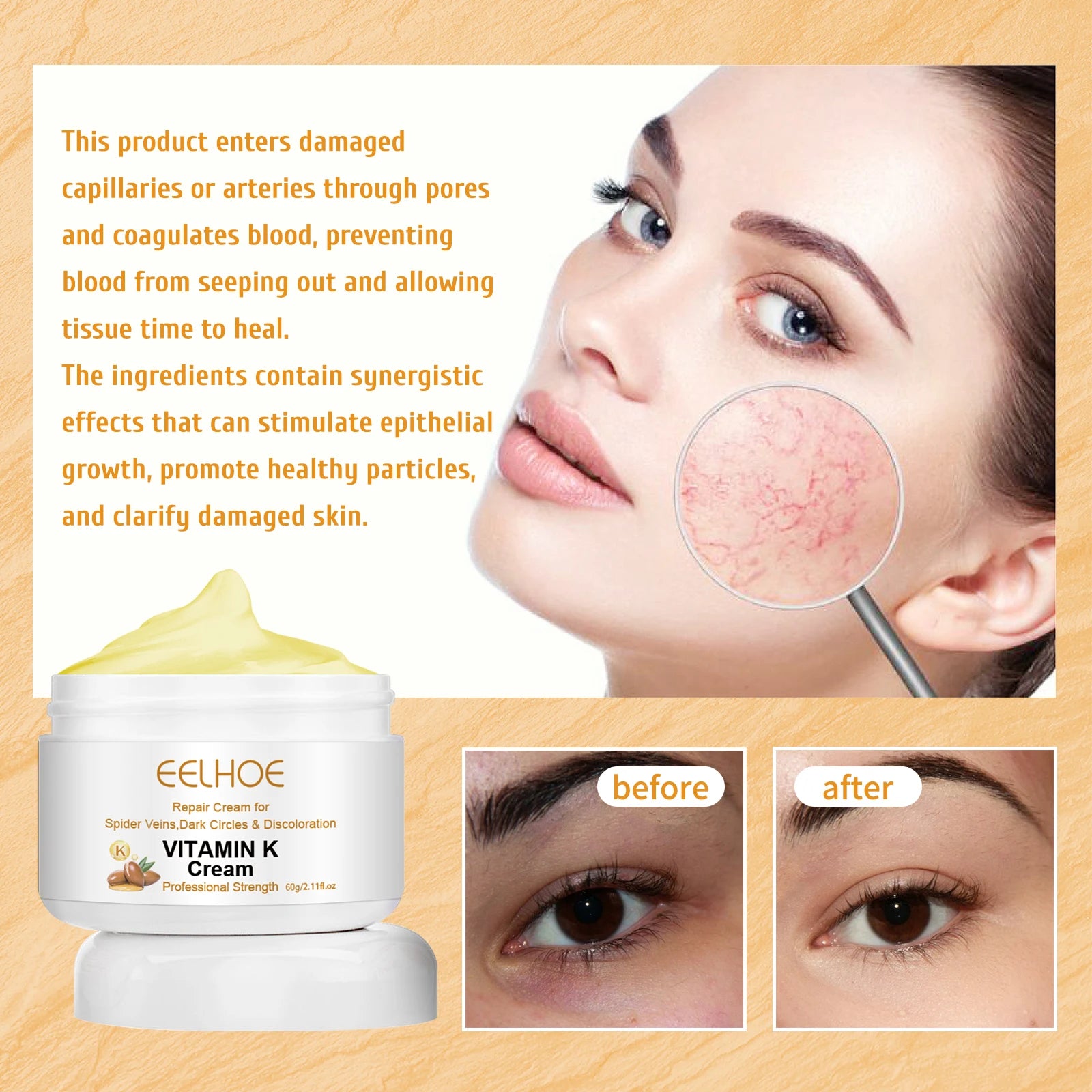 EELHOE Vitamin K Herbal Vein Care Cream