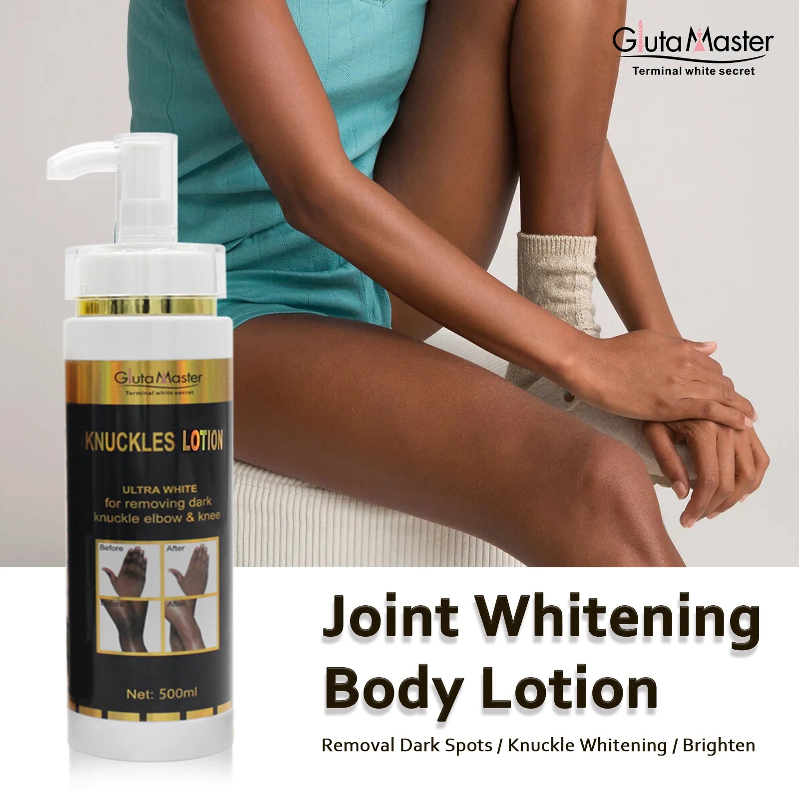 Whitening & Brightening Skin Cream – For Knuckles, Knees, and Elbows