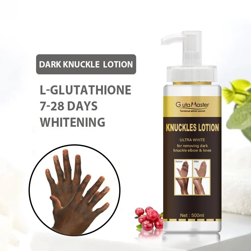 Whitening & Brightening Skin Cream – For Knuckles, Knees, and Elbows