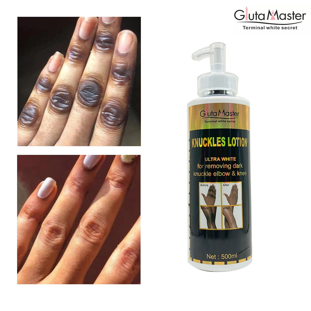 Whitening & Brightening Skin Cream – For Knuckles, Knees, and Elbows