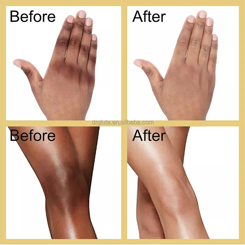 Whitening & Brightening Skin Cream – For Knuckles, Knees, and Elbows
