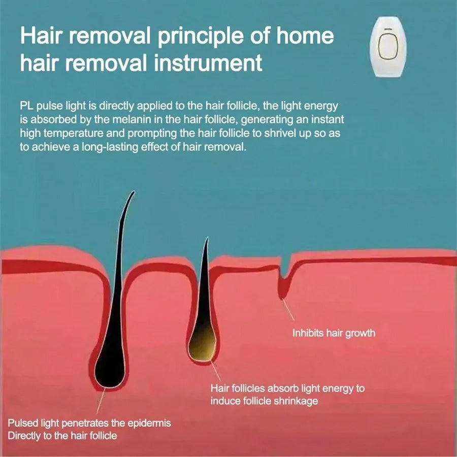 All-in-One Hair Removal Device – Permanent Hair Reduction for Body & Bikini Areas