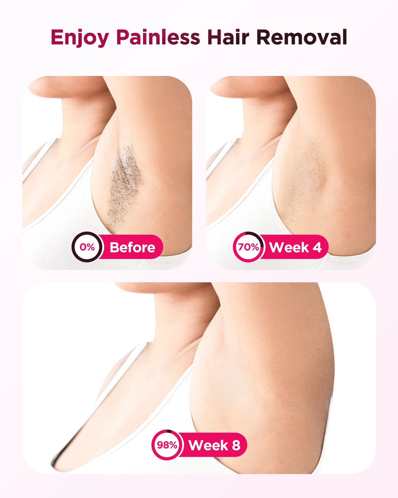 IPL Flash Laser Hair Removal – Permanent & Painless Epilator for Body, Bikini, and Face