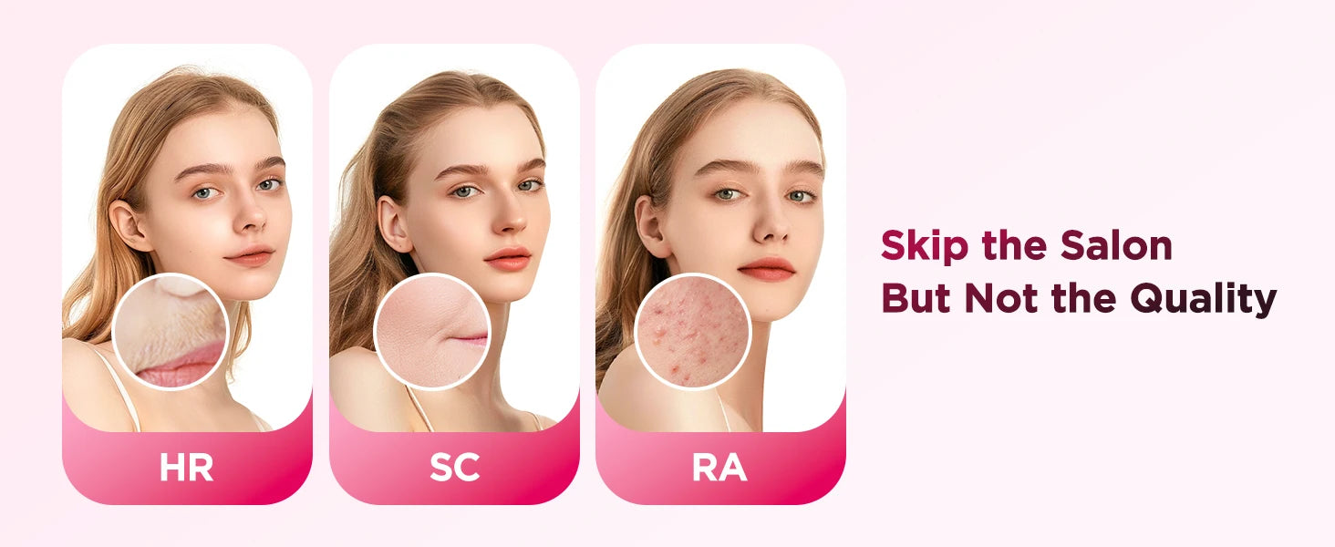 IPL Flash Laser Hair Removal – Permanent & Painless Epilator for Body, Bikini, and Face